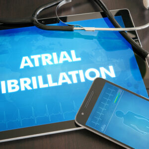 All You Need to Know about Atrial Fibrillation