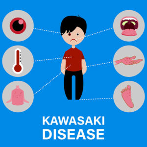 Kawasaki disease &#8211; causes and symptoms