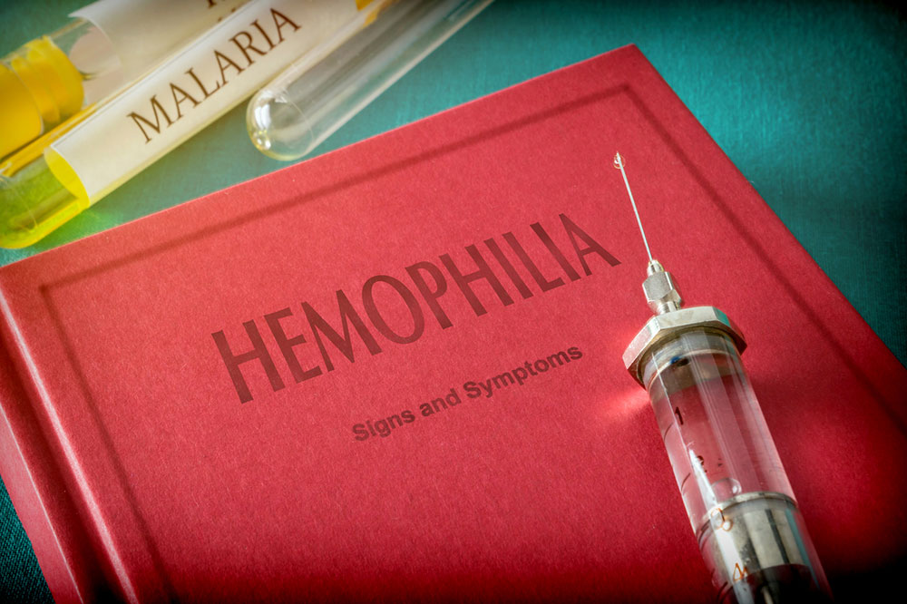 Hemophilia &#8211; 4 main symptoms and their severity