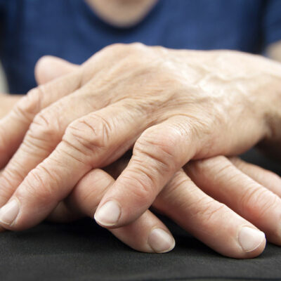 Rheumatoid Arthritis &#8211; Diagnosis and Treatment Options