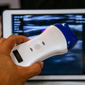 Benefits of portable ultrasound machines