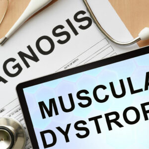 Common signs of muscular dystrophy